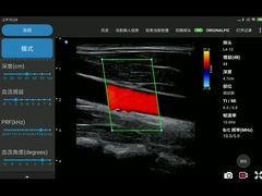 antenne réseaux rectilignes électronique Iphone de scanners sans fil d'ultrason de 12MHz