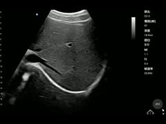 Scanner tenu dans la main de santé de sonde convexe portative du dispositif ISO13485 médical