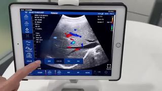 Solution tout-en-un à ultrasons portable sans fil