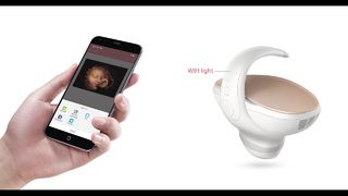 Marvoto Fetus Camera M1 - Échographie portative 3D