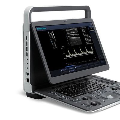 acheter 15,6 » machines d'ultrason d'affichage à cristaux liquides Sonoscape E2 avec la garantie de 2 ans online manufacture
