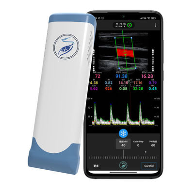 acheter Scanner à ultrasons portable sans fil 12 MHz pour iPhone et iPad | Sonde Doppler couleur à réseau linéaire électronique online manufacture