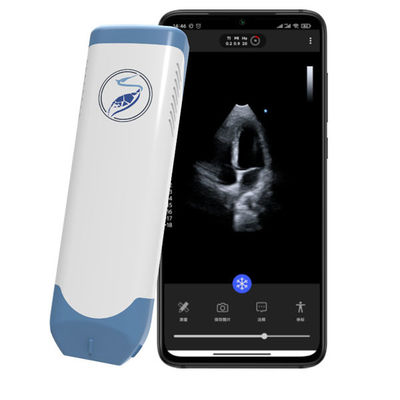 acheter Scanner à ultrasons portatif sans fil à réseau phasé, 5 MHz, échographie cardiaque de poche pour l'échocardiographie POCUS online manufacture