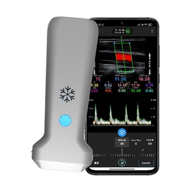 acheter Scanner à ultrasons Doppler couleur portable linéaire sans fil WiFi | Imagerie en temps réel à 30 FPS | Sonde à ultrasons médicale portative online manufacture