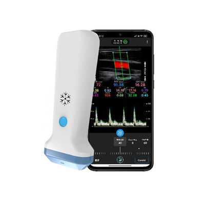 acheter Scanner à ultrasons portatif linéaire sans fil | Sonde à ultrasons Doppler couleur portable 4/8,3/12 MHz online manufacture