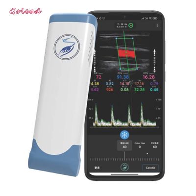 acheter Scanner portatif sans fil électronique 12MHz d'ultrason de Wifi d'antenne réseaux rectilignes online manufacture