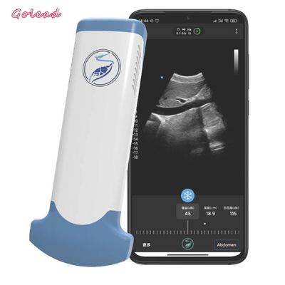 acheter Dispositif sans fil d'ultrason de rangée convexe électronique pour le téléphone portable online manufacture