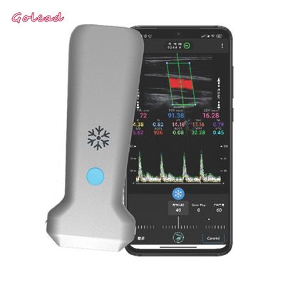 acheter scanner convexe d'ultrason de sonde de 126mm pour le nerf vasculaire de MSK online manufacture