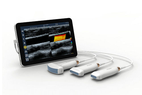 acheter Scanner à ultrasons portatif linéaire USB type-c, sonde à ultrasons Android portative 10MHz pour vasculaire et POCUS online manufacture