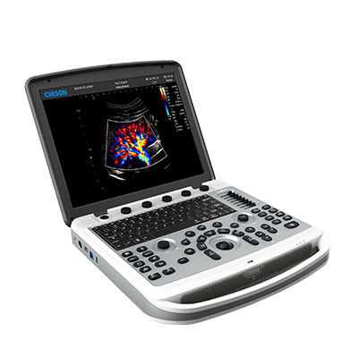acheter Machine portative d'ultrason d'ordinateur portable de 120° Chison SonoBook 6 rotatifs online manufacture
