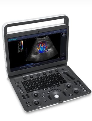 acheter ultrason de BW de machine d'ultrason de 15.6inch LED Sonoscape E1 Exp online manufacture