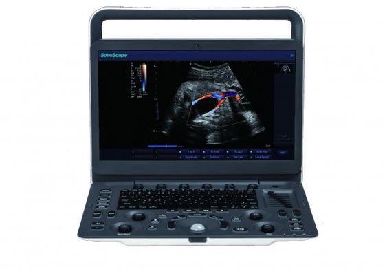 acheter 7 machine portative d'ultrason de SonoScape E3 de niveaux de représentation avec le moniteur de 15,6 pouces online manufacture