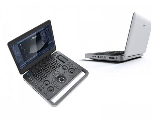 acheter Smart aperçoivent la machine d'ultrason de SonoScape de l'ordinateur portable 500GB avec 15,6 » affichages à cristaux liquides online manufacture