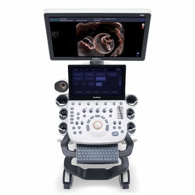acheter machine d'ultrason de 4D Elastography SonoScape pour OB et gynécologie online manufacture