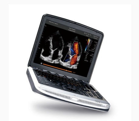 acheter Machine approuvée par le FDA Chison SonoBook 8 d'ultrason d'ordinateur portable pour l'échocardiographie online manufacture