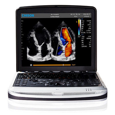 acheter Facile de porter la machine d'ultrason d'ordinateur portable de 4D Chison SonoBook 9 online manufacture