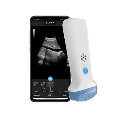 acheter Sortie HDMI Scanner à ultrasons convexe portable sans fil 3.6 MHz Portable Doppler couleur POCUS Ultrasons online manufacture