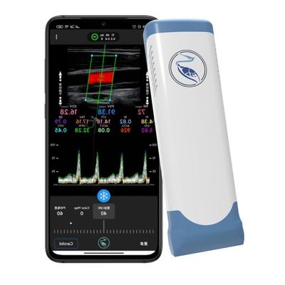 acheter Vues du scanner 100 d'ultrason d'Echo Color Doppler Wireless Handheld online manufacture