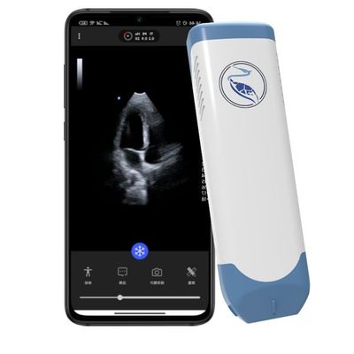 acheter Scanner tenu dans la main d'ultrason de la profondeur 18.9cm pour Iphone 3.6MHz online manufacture