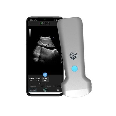 acheter Scanner à ultrasons portatif convexe sans fil ISO13485 | Sonde à ultrasons Doppler couleur portable online manufacture