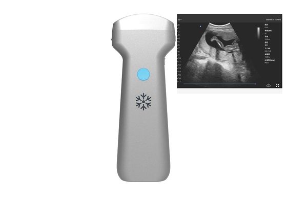 acheter Sonde sans fil convexe 2MHz 3.6MHz 5MHz d'ultrason de rangée convexe électronique online manufacture