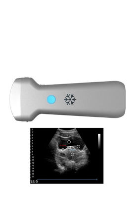 acheter Sonde sans fil convexe d'ultrason d'Ultrasonication pour la gynécologie online manufacture