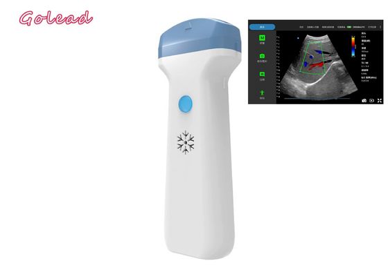 acheter Sonde sans fil d'ultrason d'Ipad d'anesthésie pour le premier soins d'examens de POCUS online manufacture