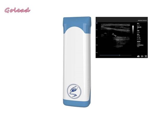 acheter sonde sans fil tenue dans la main de l'ultrason 12MHz pour des inspections extérieures online manufacture
