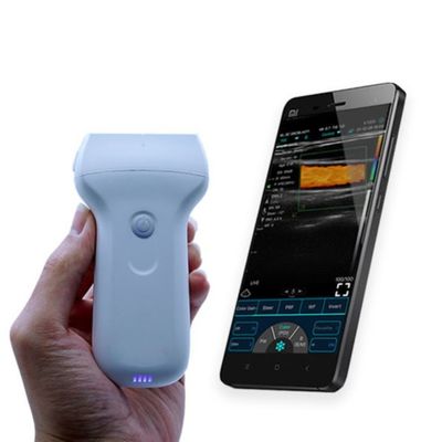 acheter Sonde à ultrasons portative sans fil à 96 éléments approuvée CE pour le diagnostic clinique en hôpital online manufacture