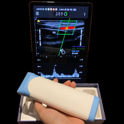 acheter Scanner à ultrasons de poche PICC à haute performance électronique linéaire online manufacture