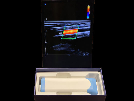 acheter Scanner à ultrasons avancé portatif de 0,2 kg avec batterie de 3000 mAh online manufacture