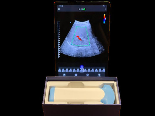 acheter Probe à ultrasons sans fil de taille poche pour les urgences online manufacture