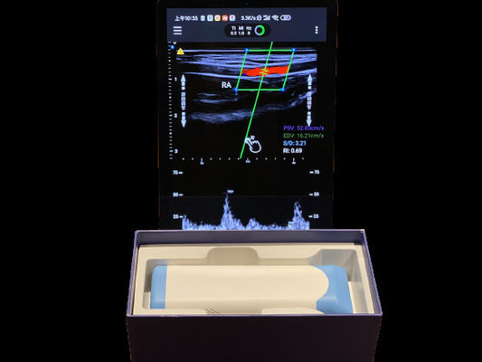 acheter Scanner électronique à ultrasons à portée de main avec une durée de travail de 2 heures online manufacture