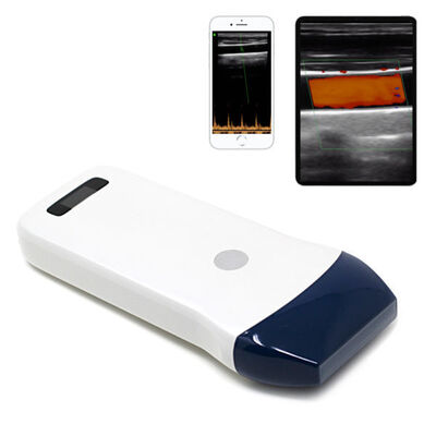 acheter Scanner à ultrasons à sonde linéaire sans fil pour accès vasculaire, bloc nerveux et imagerie musculo-squelettique online manufacture
