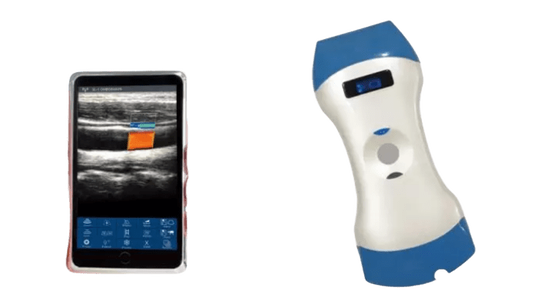 acheter Sonde à ultrasons portable sans fil à double tête à 128 éléments — Une sonde pour l'imagerie profonde, l'imagerie superficielle et le diagnostic sur le lieu de soins online manufacture