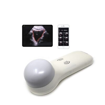 acheter Scanner de vessie portable sans fil 4D pour la mesure du volume urinaire au point de service online manufacture