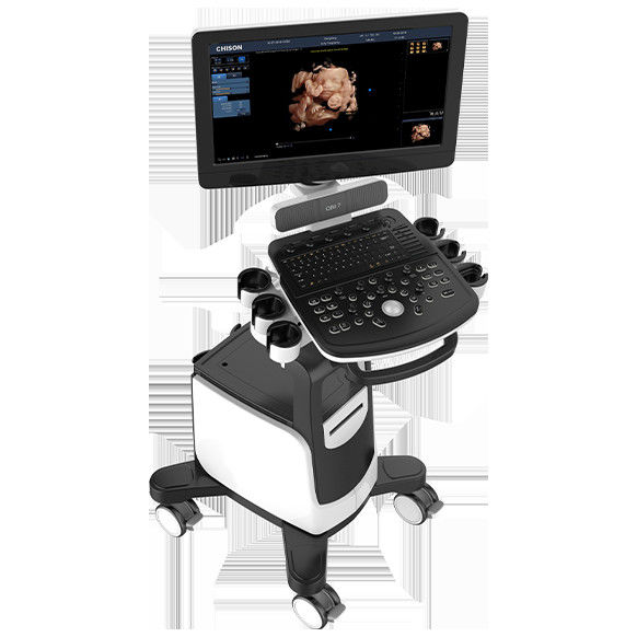 Machine Chison QBit 7 d'ultrason de Doppler de couleur de 19 pouces LED