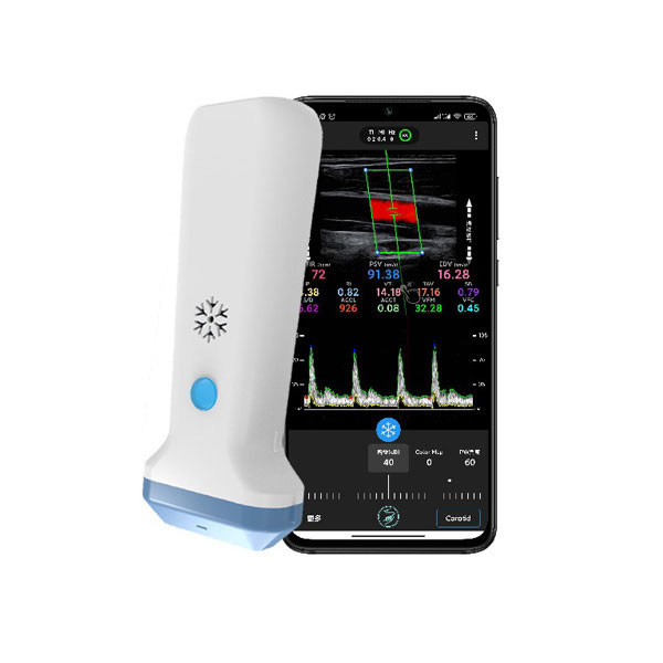 Scanner à ultrasons portatif linéaire sans fil | Sonde à ultrasons Doppler couleur portable 4/8,3/12 MHz