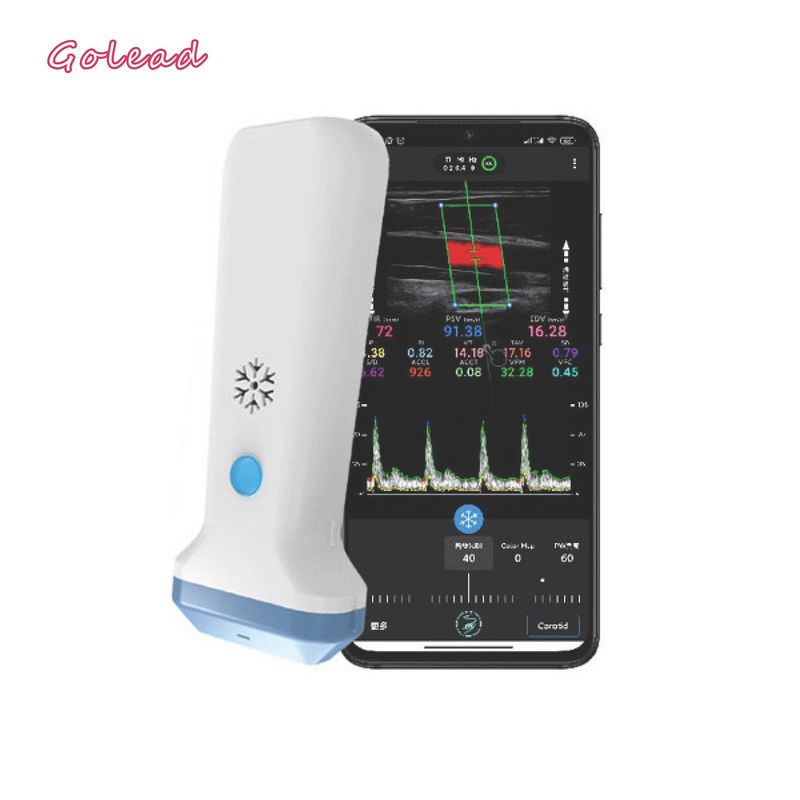 scanner de type sondeur d'ultrason de radio de 12MHz 3000mAh pour Iphone