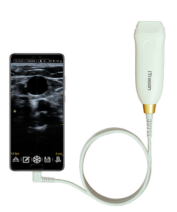 Scanner d'échographie portatif de 20 mm de profondeur pour l'évaluation vasculaire périphérique et l'accès vasculaire guidé par ultrasons
