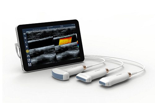 Scanner à ultrasons portatif linéaire USB type-c, sonde à ultrasons Android portative 10MHz pour vasculaire et POCUS