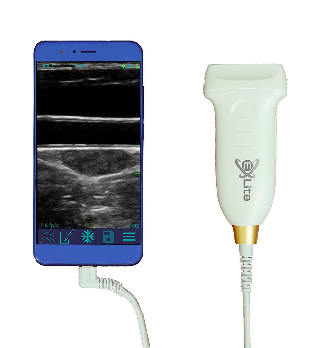 Scanner à ultrasons portatif linéaire USB type-c, sonde à ultrasons Android portative 10MHz pour vasculaire et POCUS
