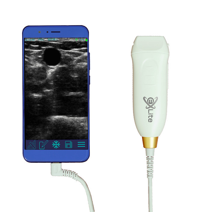 Scanner à ultrasons portable avec sonde linéaire haute fréquence 12 MHz pour un accès vasculaire précis et des procédures d'insertion PICC