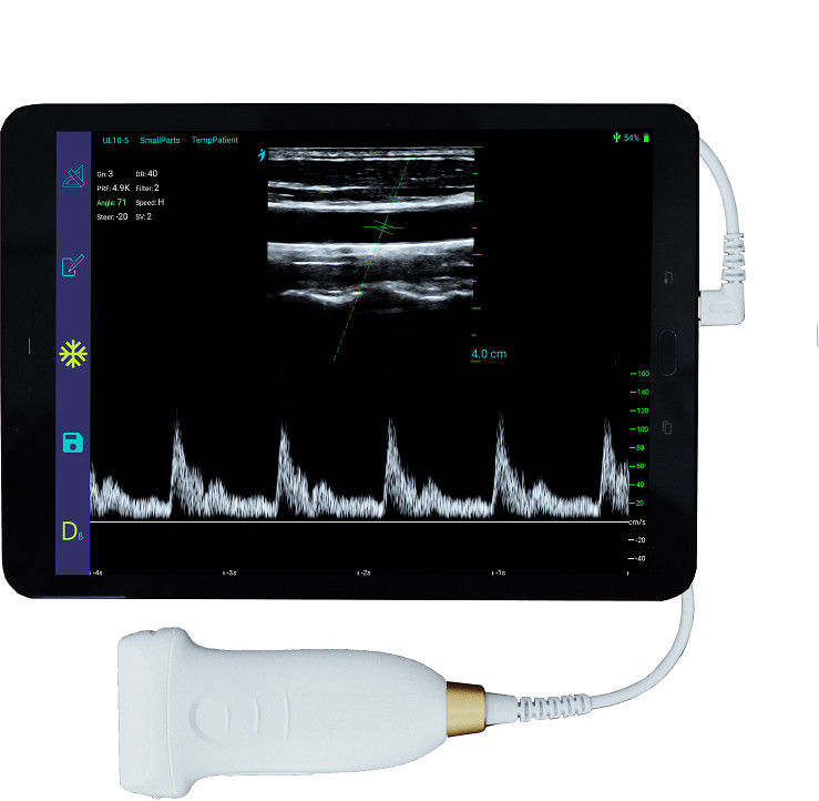 scanner sans fil portatif d'ultrason de 10MHz Android avec le type-c connexion