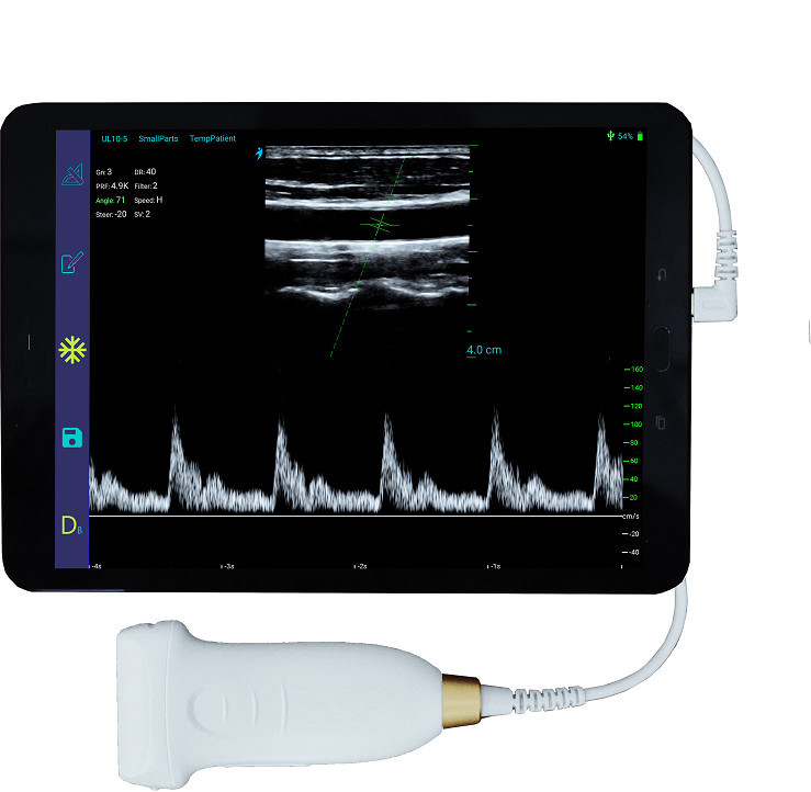 Scanner à ultrasons portatif linéaire USB type-c, sonde à ultrasons Android portative 10MHz pour vasculaire et POCUS