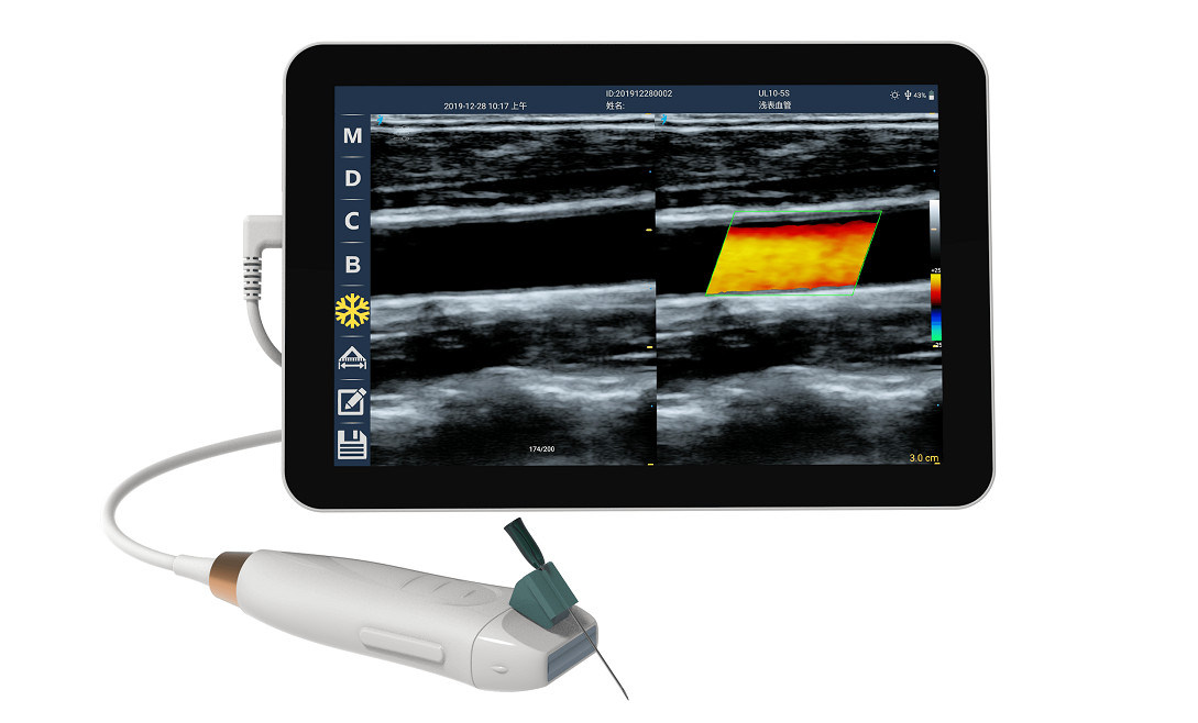 Scanner à ultrasons portable avec sonde linéaire haute fréquence 12 MHz pour un accès vasculaire précis et des procédures d'insertion PICC