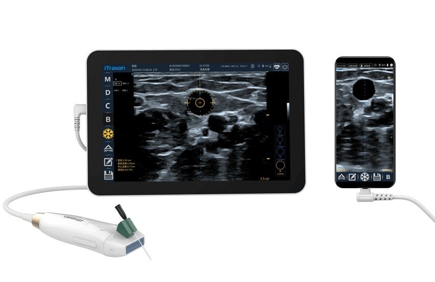 Scanner d'échographie portatif de 20 mm de profondeur pour l'évaluation vasculaire périphérique et l'accès vasculaire guidé par ultrasons