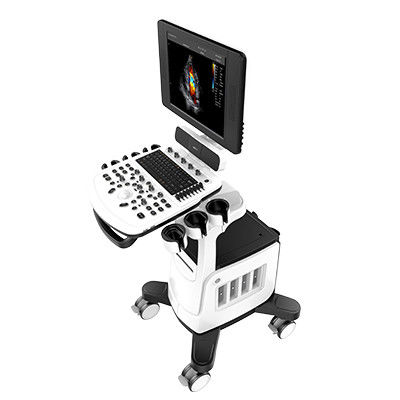 Scanner Chison Qbit 5 d'ultrason de Doppler de couleur avec 15 pouces LED