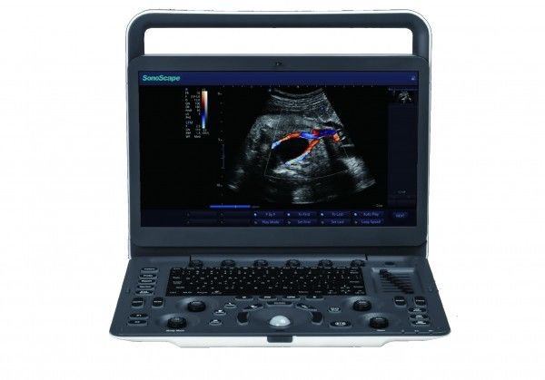 7 machine portative d'ultrason de SonoScape E3 de niveaux de représentation avec le moniteur de 15,6 pouces