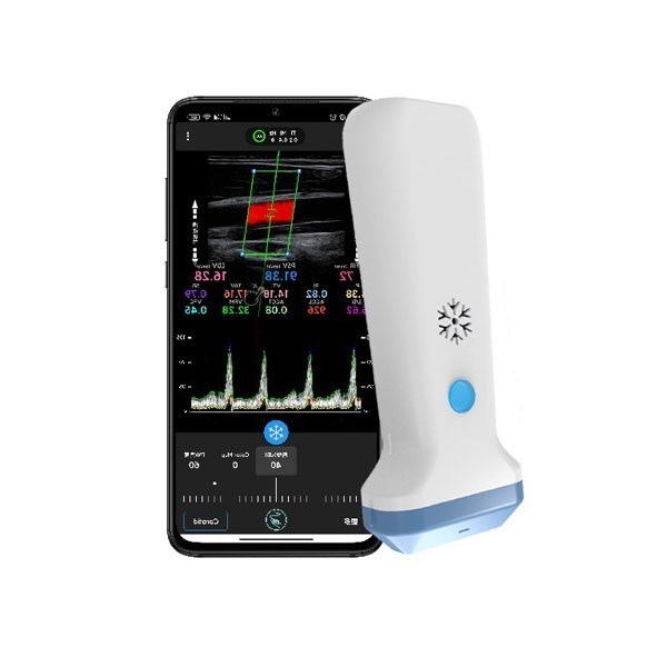 Scanner à ultrasons linéaire sans fil Doppler couleur Portable 12.6 cm échographie POCUS Portable pour les professionnels de la santé